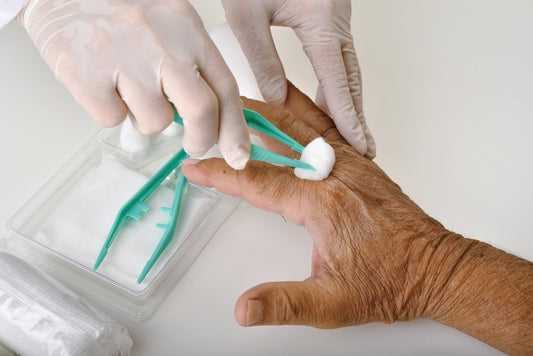When to Use Antimicrobial Wound Dressings