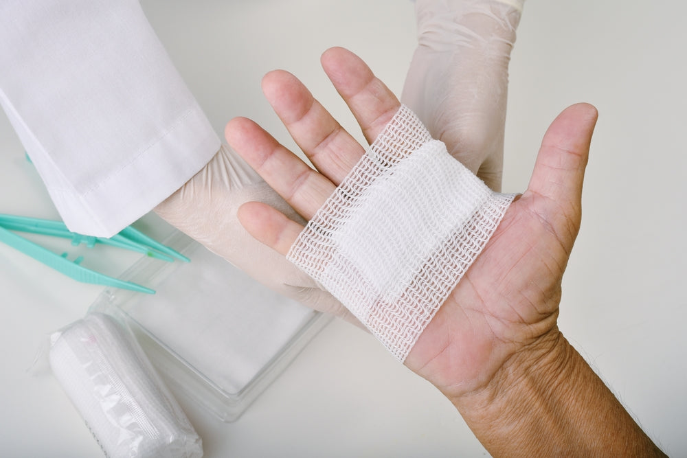 Burn Care at Home: What to Use and What to Avoid