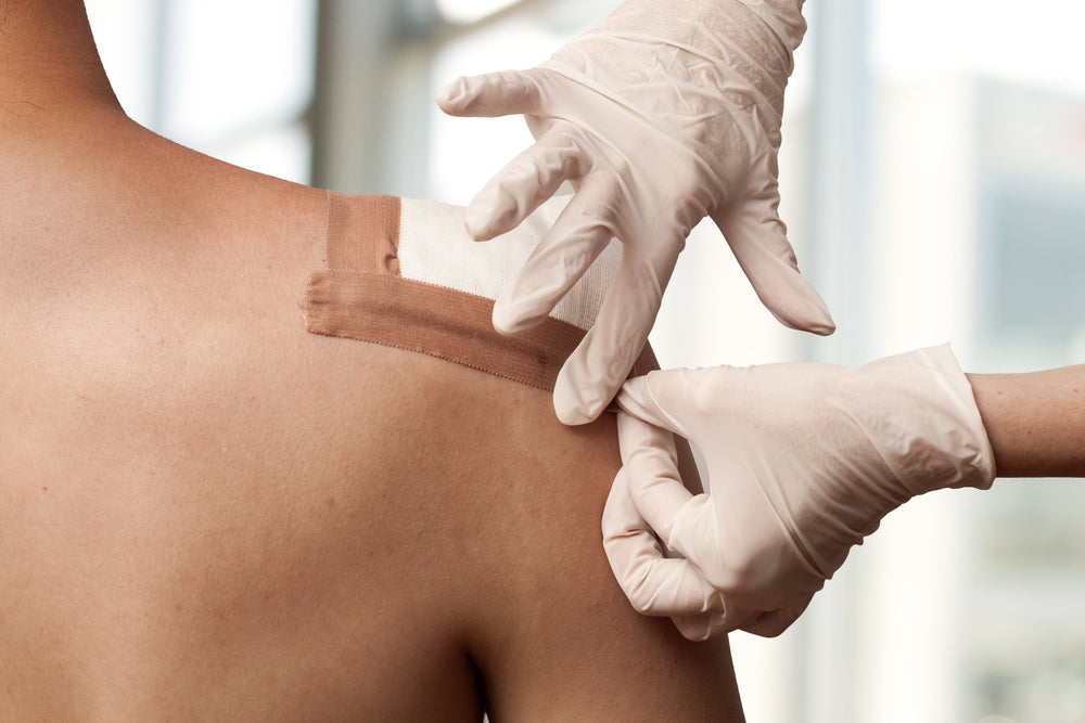 Wound Closure Strips vs Stitches: What to Know