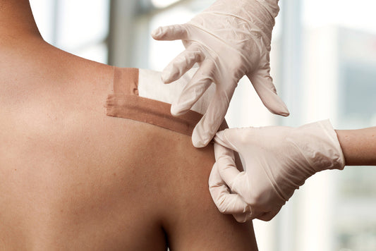 Wound Closure Strips vs Stitches: What to Know