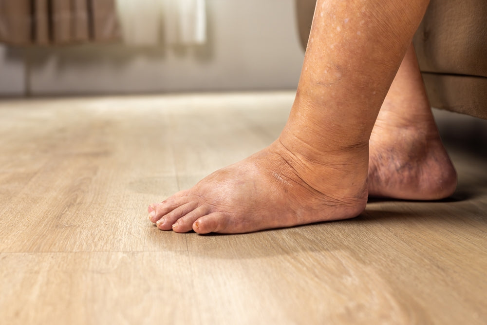 Best Socks and Insoles for Diabetic Foot Health