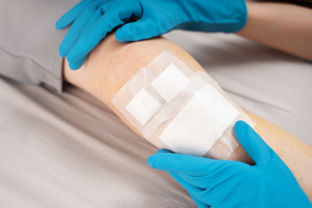 How to Choose the Right Wound Dressing for Faster Healing