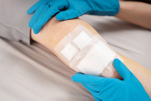 How to Choose the Right Wound Dressing for Faster Healing