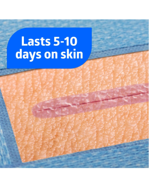 OptiClose Essential Surgical Adhesive, 0.55 mL