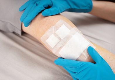 Wound Healing & Skin Protection